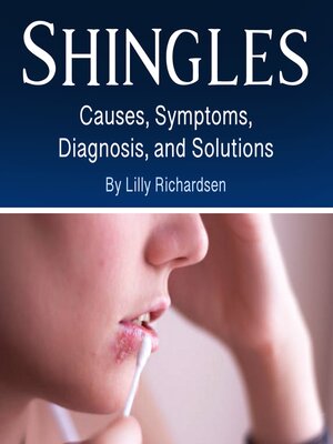 cover image of Shingles